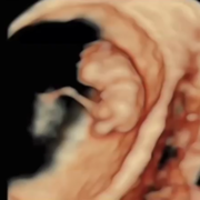 anatomy-fetus.png