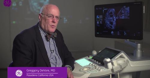 Voluson benefits of e4D imaging & Fetal Heart Education video featuring Dr. DeVore