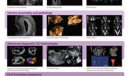 Voluson Ultrasound Reproductive Medicine Poster (EN)