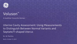 2019 ISUOG - Uterine Cavity Assessment: Using Measurements to Distinguish Between Normal Variants and Septate,T-shaped Uterus (Dr. Martins)