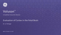 2019 ISUOG - Evaluation of Cortex in the Fetal Brain (Dr. Malinger)