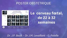 Cerveau Fœtal Poster Obst FR