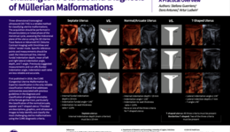 Challenges in Ultrasound Diagnosis of Müllerian Malform ...