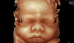 Fetal Medicine webinars
