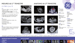 Guidelines en échographie foetale