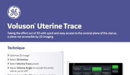 Voluson Uterine Trace Quick Guide (2021)