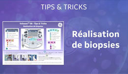 Biopsies Tips & Tricks FR