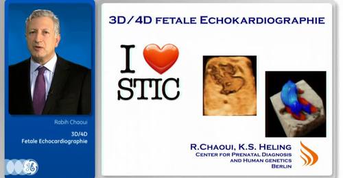 Dr. Chaoui: 3D/4D Fetal Echocardiography