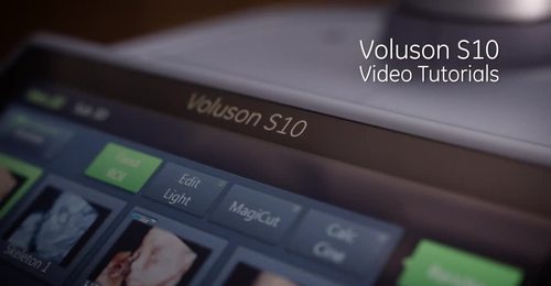 Voluson S10 - Getting Started Video