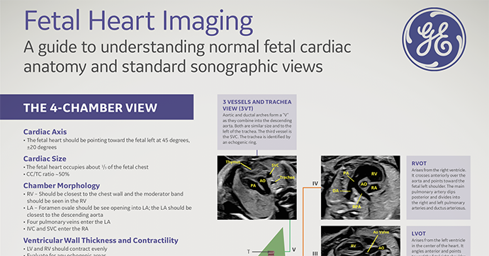 Voluson Fetal Heart Poster - A guide to understanding normal fetal cardiac anatomy & standard sonographic views (2019)