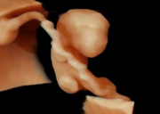 3d-of-18-mm-embryo-with-ys.jpg