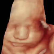 face-fetus2.png