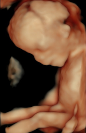 fetus-13.jpeg