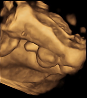 male-fetal-genetalia.jpg
