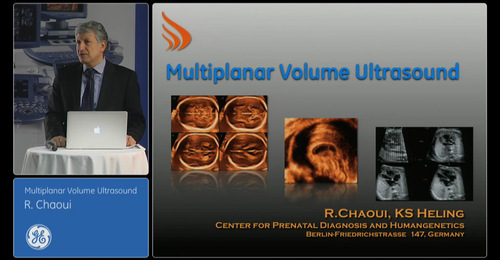 Advanced VISUS:  Multiplanar Volume Ultrasound - Dr. Chaoui