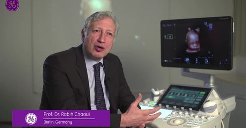 Voluson Real-time 4D imaging w/e4D Education video featuring Dr. Chaoui