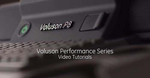 Voluson Signature & Performance BT16 - GYN educational video