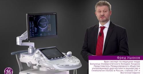 Фред Ушаков: Нейросонография плода в 17 недель беременности при помощи линейного датчика 9L