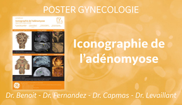 Adénomyose - Poster Gyn FR