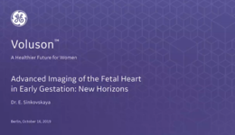 2019 ISUOG - Advanced Imaging of the Fetal Heart in Early Gestation: New Horizons (Dr. Sinkovskaya)