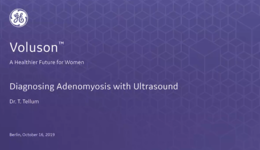 2019 - ISUOG - MTE session - Diagnosing Adenomyosis with Ultrasound (Tellum)