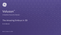 2019 - ISUOG - 3D embryo (Dr. Benoit)