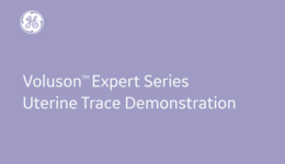 Voluson Expert Series Uterine Trace Demonstration (2020)