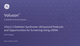 2019  ISUOG - Ultrasound Features and Opportunities for Screening Using cfDNA (Dr. Chaoui)