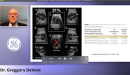 ISUOG 2020 - fetalHQ, the New Standard for Cardiac Evaluation - Dr. DeVore
