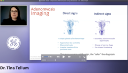 ISUOG 2020 - Diagnosing Adenomyosis using Ultrasound - Dr. Tellum