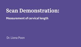 Cervical Length Measurement at Mid-Gestation using RIC6-12 Probe (Dr. Poon)