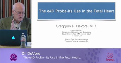 ISUOG 2016 Meet the e4D Expert: Dr. Devore- The e4D Probe its use in the Fetal Heart