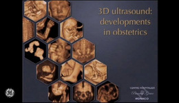 10 years VISUS - Lecture: Volume Ultrasound in Obstetrics and Gynecology with Dr. Benoit