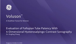 ISUOG 2018 - Evaluation of Fallopian Tube Patency With 4-Dimensional Hysterosalpingo-Contrast Sonography with Dr. Zhang