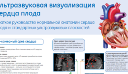 Fetal Heart Poster (RU)