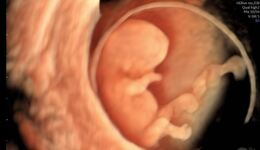 Advanced Fetal Ultrasound Course