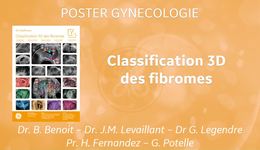 Fibromes 3D Poster Gyn FR