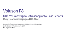 GYN Transvaginal Ultrasound Case Reports using Harmonic Imaging ...