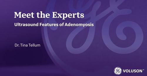 ISUOG 2021- Ultrasound features of adenomyosis (Dr. Tellum)