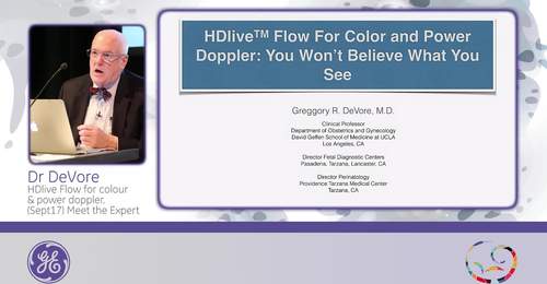 ISUOG 2015 - Dr. DeVore: HD<i>live</i> Flow for colour & power doppler
