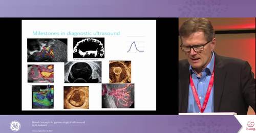 ISUOG 2017 - Novel concepts in gynaecological ultrasound- Dr. Jurkovich