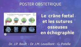 Crâne Fœtal Poster Obst FR