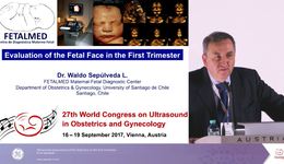 ISUOG 2017 - Ultrasound assessment of fetal face in 1st trimester Dr. W Sepulveda