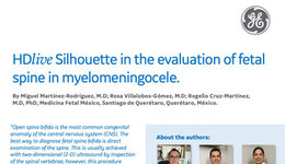Evaluation myelomeningocele fetal spine using Voluson HDlive ...