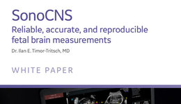 SonoCNS Reliable, accurate, and reproducible fetal brain ...