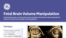 Fetal Brain Volume Manipulation Quick Card (Voluson, 2020)