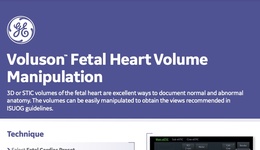Fetal Heart Volume Manipulation Quick Card (Voluson, 2020)