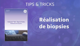 Biopsies Tips & Tricks FR