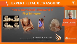 3D Ultrasound in 1st Trimester – prof. Rabih Chaoui