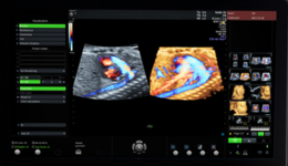 Fetal Heart Imaging